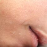 pelle-secca-in-inverno-cause-e-rimedi-efficaci