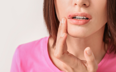 Herpes labiale estivo: perché compare più spesso al sole