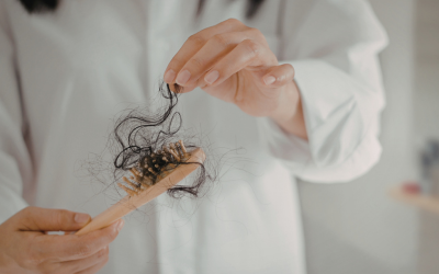 Caduta dei capelli autunnale: prevenire a settembre è fondamentale
